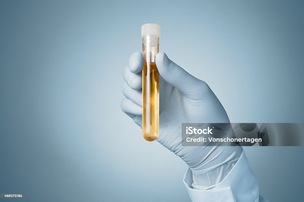 Doctor's hand with urine sample Doctor holding a bottle of urine sample Urine Sample Stock Photo