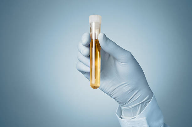 Doctor's hand with urine sample Doctor holding a bottle of urine sample urine stock pictures, royalty-free photos & images