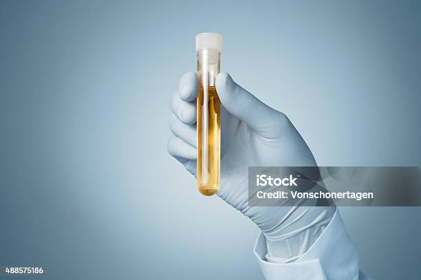 Doctors Hand With Urine Sample Stock Photo - Download Image Now - Urine Sample, Urine, Drug Test
