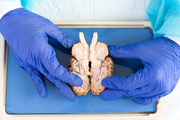 istock Pathologist holding a cross section of the brain 488784325