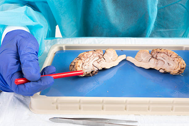断面の牛の脳の実験 - nerve cell healthcare and medicine research human hand ストックフォトと画像