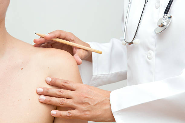 istock Skin Cancer 489012510