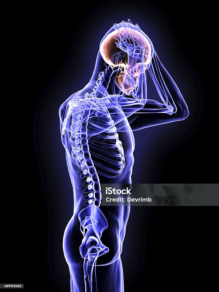 X-Ray Concussion of the Brain Full Body XRay Scan Concussion Stock Photo