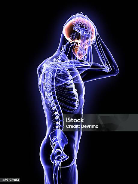 Xray Concussion Of The Brain Stock Photo - Download Image Now - Concussion, Human Skeleton, The Human Body