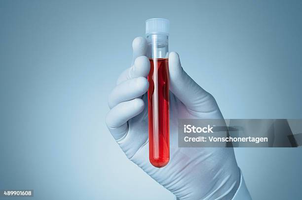 Hand With Blood Sample Stock Photo - Download Image Now - Blood, 2015, Biochemistry