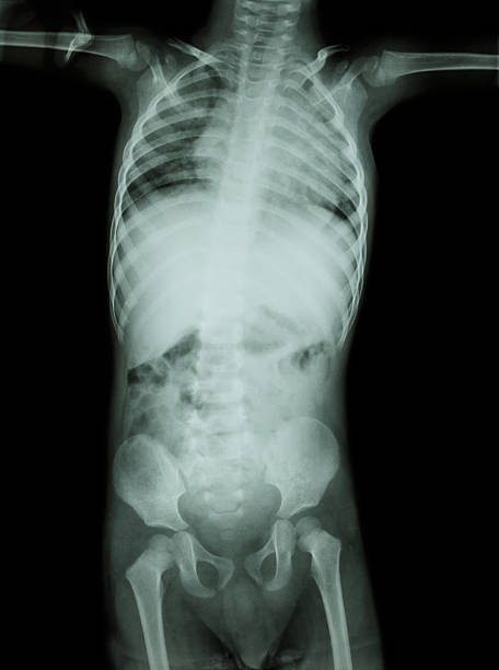 film x-ray ganzen körper von kind - haunch stock-fotos und bilder
