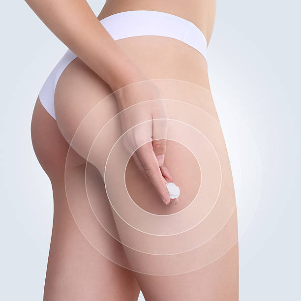 mujer aplicar crema de cosméticos cellulite en la nalga - haunch fotografías e imágenes de stock