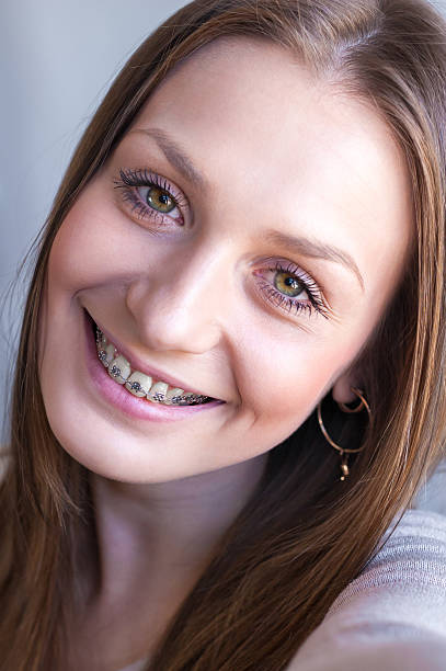 istock happy beautiful girl with braces 490142114