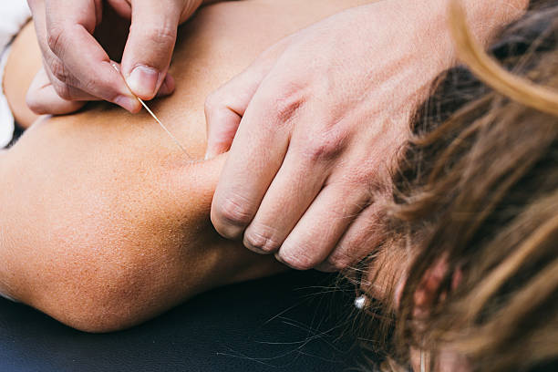 physiotherapist fazer uma punção seca - massaging massage therapist rear view human hand imagens e fotografias de stock