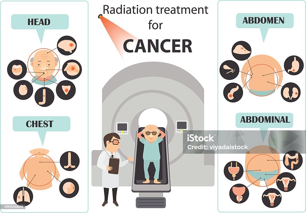 cancer cervical symptômes - clipart vectoriel de 2015 libre de droits