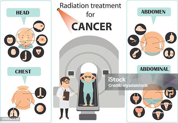 Cancer Cervical Symptômes Vecteurs libres de droits et plus d'images vectorielles de 2015 - 2015, Bouche humaine, Buste - Partie du corps