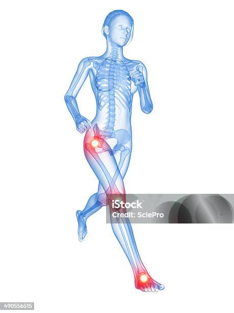 Painful Joints Stock Photo - Download Image Now - Anatomy, Biology, Biomedical Illustration