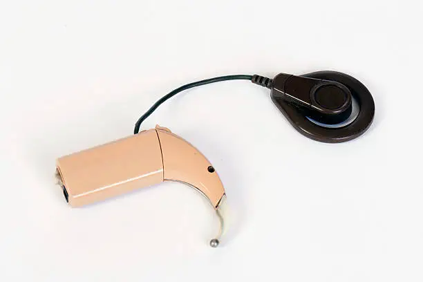 Photo of Cochlear implant