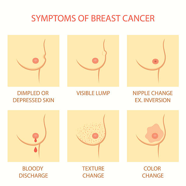 symptoms of breast cancer skin symptoms of breast cancer, self examination, tumor body exam bumpy stock illustrations