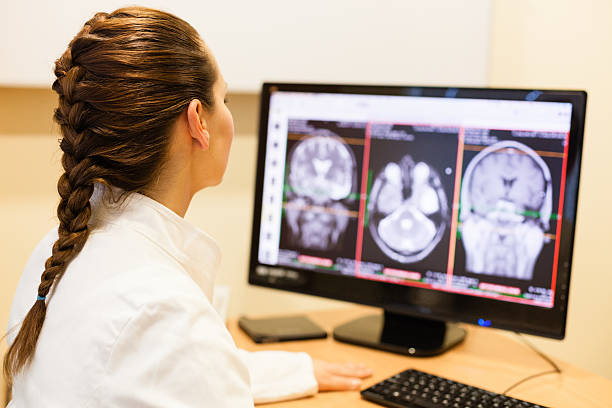 female 담담의 분석 뇌 mri 스캔 - radiologist x ray computer medical scan 뉴스 사진 이미지