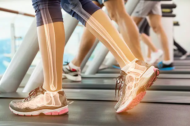 Photo of Highlighted ankle of woman on treadmill