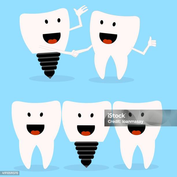 Dental Implant Stock Illustration - Download Image Now - 2015, Dentist, Enamel