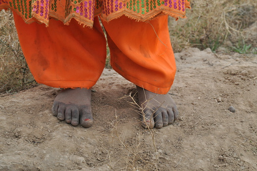 Afghani child without shoe.