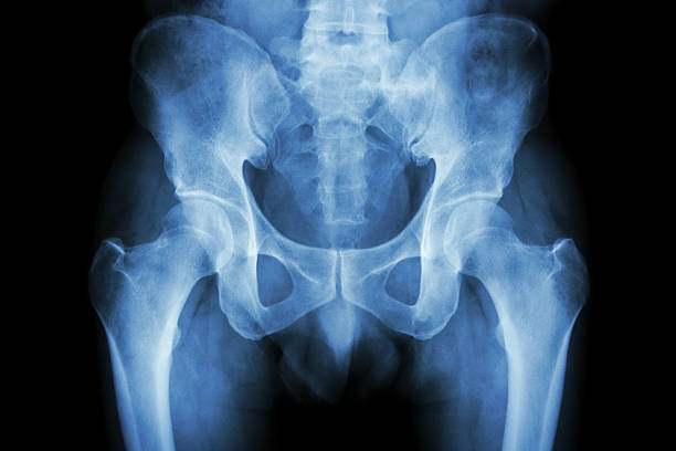 película de radiografía normal de pelvis - haunch fotografías e imágenes de stock