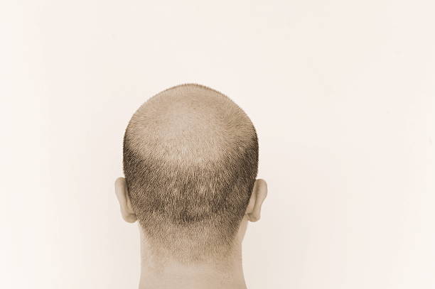 istock back bald head shot of male 491331348