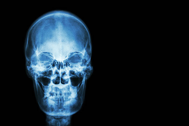 istock film x-ray skull of human 491379308