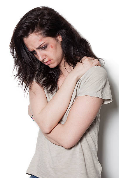 istock Thoughtful beaten up girl 491445279