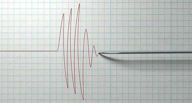 Photo of Polygraph Needle And Drawing