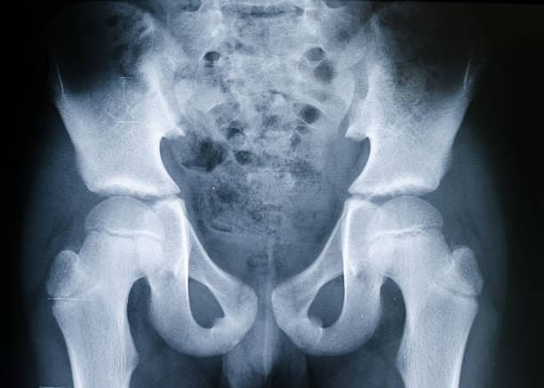 x-ray de la hanche et le bassin - x ray image coccyx radiologist hip photos et images de collection