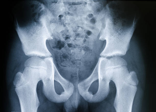 raios-x da pelve e articulação da anca - x ray image coccyx radiologist hip imagens e fotografias de stock