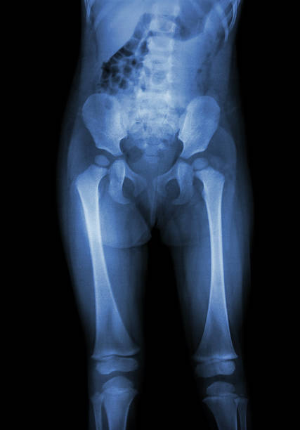Film x-ray normal body of child (abdomen,buttock,thigh,knee) Film x-ray normal body of child (abdomen,buttock,thigh,knee) hip joint x stock pictures, royalty-free photos & images