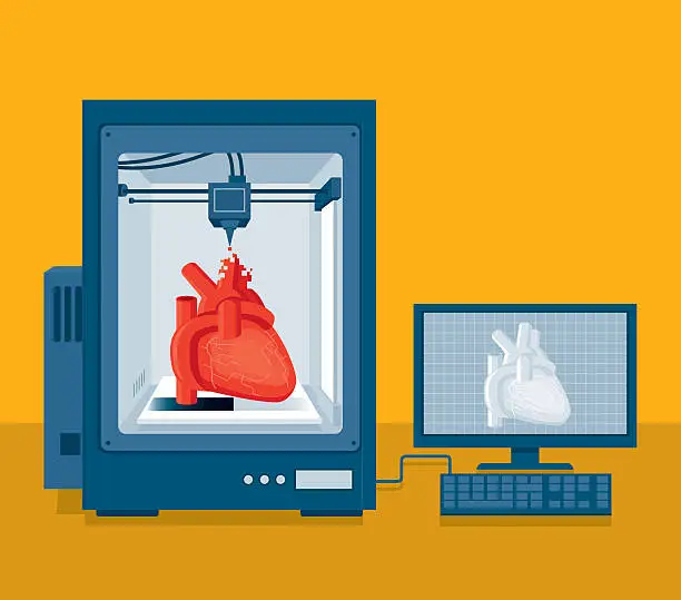 Vector illustration of Heart transplant