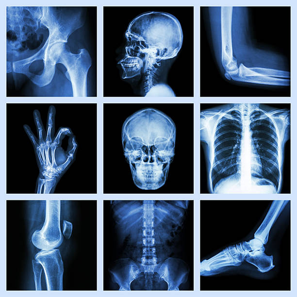 Collection X-ray part of human Collection X-ray part of human hip joint x stock pictures, royalty-free photos & images