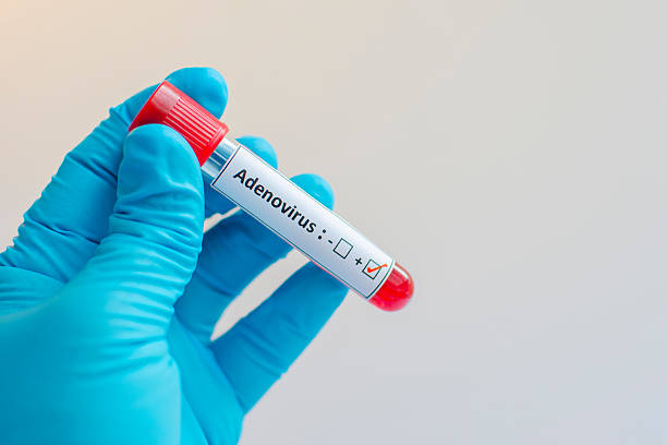 positivo por adenovirus - the vomiting of blood fotografías e imágenes de stock