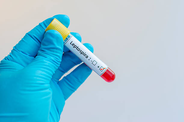 Leptospira positive Blood sample positive with Leptospira leptospira stock pictures, royalty-free photos & images