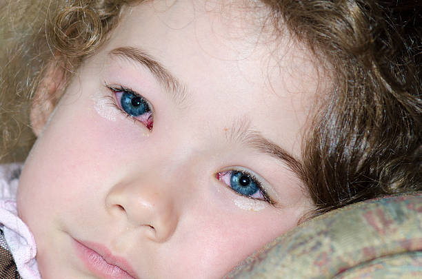 gros plan sur les yeux d'une petite fille conjonctivite - conjunctivitis sore eyes child human eye photos et images de collection