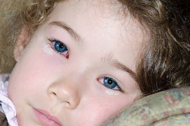 zbliżenie na dziewczynka jest oczy o zapalenie spojówek, - conjunctivitis sore eyes child human eye zdjęcia i obrazy z banku zdjęć