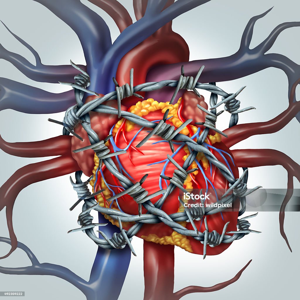 Heart Pain Heart pain medical health care concept as a human cardiovascular organ wrapped in sharp barbed wire as a metaphor for coronary problems and health decline in blood circulation. 2015 Stock Photo