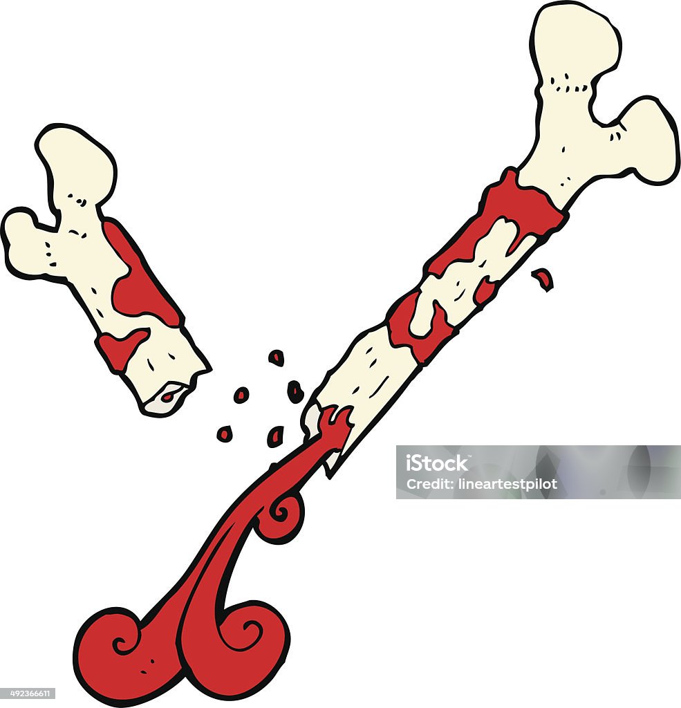 Gross Broken Bone Cartoon Stock Illustration - Download Image Now -  Bizarre, Cheerful, Clip Art - iStock
