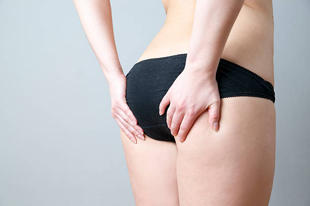 buttocks massage against cellulite - kvinna stor rumpa bildbanksfoton och bilder