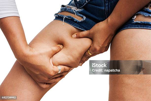 Fat Thighs Cellulite Of A Teenage Girl Stock Photo - Download Image Now - Overweight, Cellulite, Thigh - Human Leg