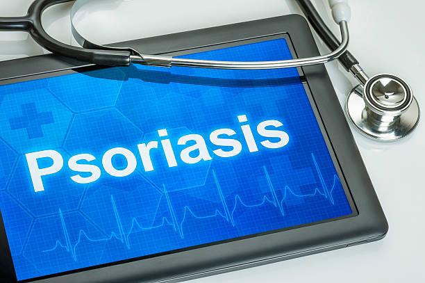 istock Tablet with the diagnosis Psoriasis on the display 492910372