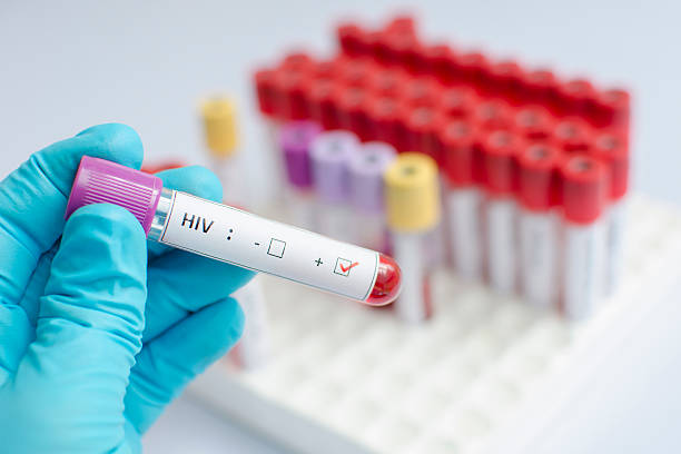 hiv bluttest - hiv virus retrovirus aids stock-fotos und bilder