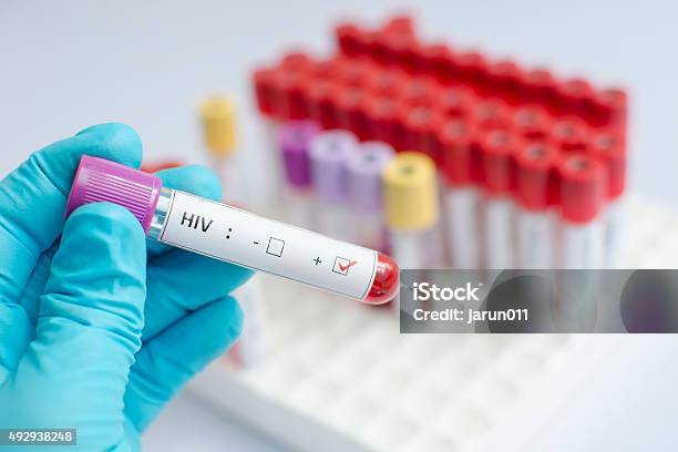 Hiv Blood Sample Stock Photo - Download Image Now - AIDS, HIV, AIDS Test