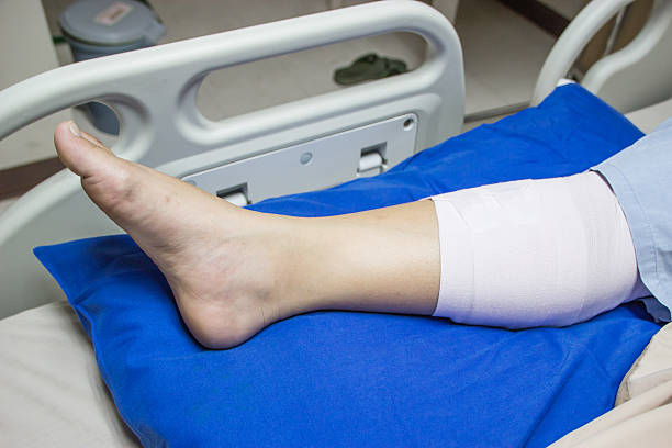 istock Bandaged leg on a hospital bed. 493064218