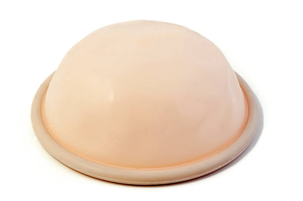 Diaphragm (contraceptive) The diaphragm is a cervical barrier type of birth control. It is a soft latex or silicone dome with a spring molded into the rim. The spring creates a seal against the walls of the vagina. iud stock pictures, royalty-free photos & images