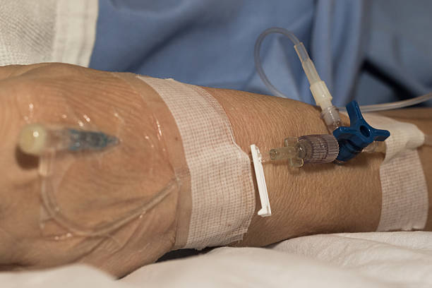 istock Hand of the patient. 493280570
