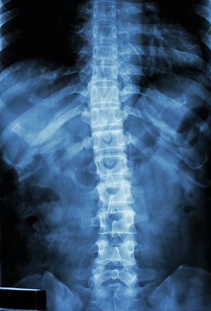 normalnej ludzkiej's piersiowej-kręgosłup lędźwiowy - x ray chest human lung rib cage zdjęcia i obrazy z banku zdjęć