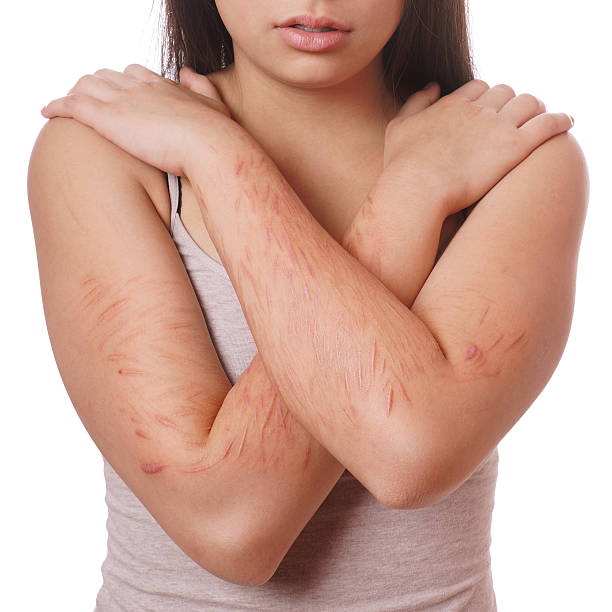 cuts and scars from self harm arms with scars and cuts from deliberate self-harm self harm photos stock pictures, royalty-free photos & images