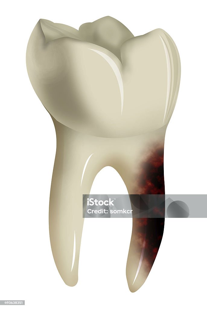 Dor de Dente isolado no fundo branco - Foto de stock de Anatomia royalty-free