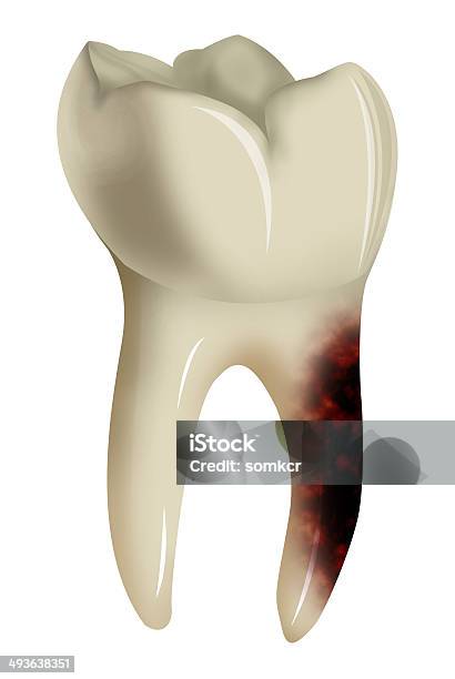 Foto de Dor De Dente Isolado No Fundo Branco e mais fotos de stock de Anatomia - Anatomia, Apodrecer, Boca Humana